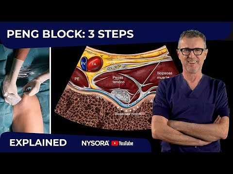PENG BLOCK: TECHNIQUE FOR SUCCESS AND SAFETY