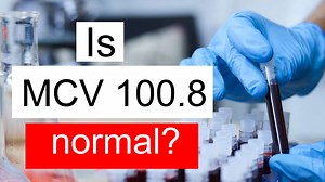 Is MCV 100.8 normal, high or low? What does Mean corpuscular volume level 100.8 mean?