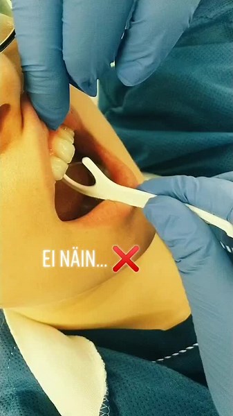 Lankaatko sinä päivittäin? #suunterveys #suunterveydenhuolto #suunterveydenedistäminen #hammashoitolassa #kainuunsote