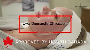 Improve skin texture and say goodbye to wrinkles and acne scars with Dermaroller Collagen Induction Therapy. | Dermaroller