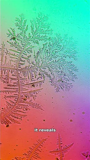 Human tears under the microscope reveal something INCREDIBLE!