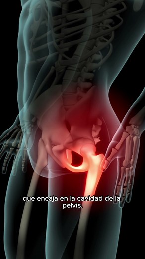 🏥✨ Una nueva cadera, una nueva vida: Acompáñanos en un viaje quirúrgico que cambia vidas. Desde la sala de operaciones te presento la cirugía de prótesis de cadera. #cirugia #salud #medicina #surgery #cirujano #medico #doctor #hospital #medicos #medicine #traumatologia #abdominoplastia #quirofano