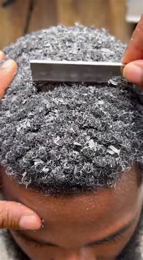 This makes my scalp crawl… but I can’t stop watching 😭#oddlysatisfying#satisfying#asmr#grossbutgood#scalp