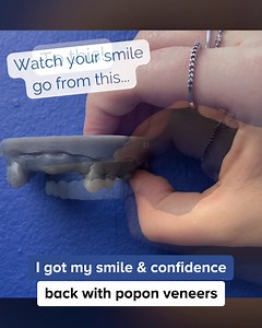 7.8K reactions · 617 shares | Don't miss ⚡$100⚡ OFF! Use code: POP100...