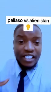Naye kati embalabe ziyingilila Waa Mulutalo lwa Pallaso ne Alien Skin | Sk Media UG