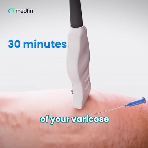 Get the Non-Surgical treatments for Varicose Veins in Bangalore. ☎️ Call us-08045681448 ✅ 50000 happy customers ✅ 15 Yrs experienced surgeons ✅ 𝐀𝐥𝐥 𝐈𝐧𝐬𝐮𝐫𝐚𝐧𝐜𝐞 𝐀𝐜𝐜𝐞𝐩𝐭𝐞𝐝 ✅ Day-Care Procedure ✅ End to end Patient care ✅ Pay in Instalments ✅ Free Pickup & drop service | Medfin