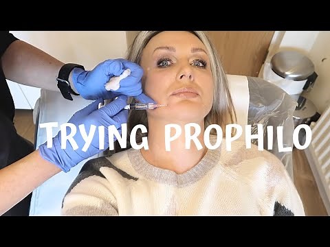Trying PROFHILO Treatment - MONDAY VLOG