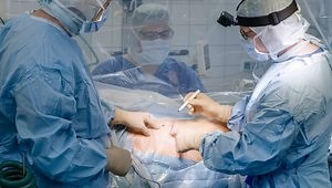 Hybrid Total Hip Arthroplasty via a Minimally Invasive Antero-Lateral Approach | Detailed Full Case Demonstration