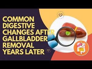 Common Digestive Changes After Gallbladder Removal Years Later