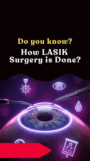 Learn With Tamil Lyrics on Instagram: "LASIK is a laser procedure that permanently reshapes the cornea to correct nearsightedness, farsightedness, and astigmatism. A surgeon creates a small corneal flap, uses an ultraviolet laser to remove precise amounts of tissue, and replaces the flap. This improves how light focuses on the retina, often eliminating the need for glasses.👁️ #eye #tamil #infovideo #surgery"