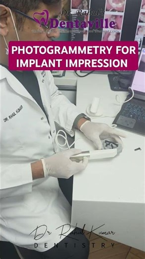 PHOTOGRAMMETRY SYSTEM FOR DIGITAL IMPLANT IMPRESSION