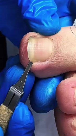 #historiasreddit #historias