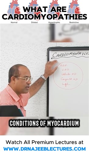 4.9K views · 123 reactions | What are Cardiomyopathies Any disorder that affects the heart muscle is called a cardiomyopathy. Cardiomyopathy causes the heart to lose its ability to pump blood well. In some cases, the heart rhythm also becomes disturbed. This leads to arrhythmias (irregular heartbeats). | Dr. Najeeb | Facebook