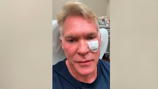 Sam Champion opens up about skin cancer diagnosis, surgery