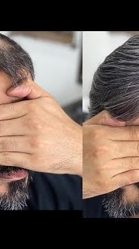 Male hair prosthesis