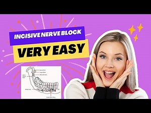 INCISIVE NERVE BLOCK PROCEDURE - Everything you need to know