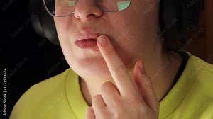 Healing cold sore on lip with finger pointing at scab. Close-up of herpes blister in recovery stage. Focus on skin healing, viral outbreak treatment, and managing irrigation.