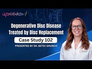 Case study 102 | Degenerative Disc Disease Treated by Disc Replacement | Presented By Dr. Grunch