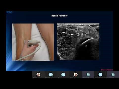 Knee Ultrasound