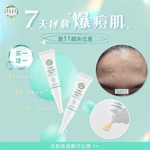 🌟 HH抗痘秘密登场！限时买1送1🔥 单支只要RM34！ 🔗https://hh-oversea.com/byepimples_b1f1 💧 HH EPR2 2%水杨酸抗痘精华 💧 #粉丝真实反馈 💬 “帮我家孩子轻松摆脱痘痘困扰！” 👧 使用第1天：冰凉舒爽、吸收超快、不油腻！ ✨ 使用第5天：痘痘明显消退，泛红减轻，熬夜也不再爆痘！ 😍 使用第7天：肤质变得平滑细腻，痘痘不再频繁复发！ 比起以前那些厚重又黏腻的痘霜，这款精华质地超轻盈，孩子天天都愿意擦！ 💡 痘肌专研配方，净痘看得见！ ✔ 2%水杨酸：深层净化毛孔，加速痘痘修复 ✔ 茶树 × 柳兰植萃：控油舒缓，调理肌肤平衡 数量有限，每人限购3组！ 👉 现在下单1就能直接带走2支！马上和痘痘说再见！🔗https://hh-oversea.com/byepimples_b1f1 🏷 订单享HH points 1%回馈 → RM15=1 HH point 🏷 新马快速到货｜寿星最高抵RM70｜VIP再享订单10%折扣 🏷 指定门市Sasa贩售中 #HH #HHherb_health #feminineca