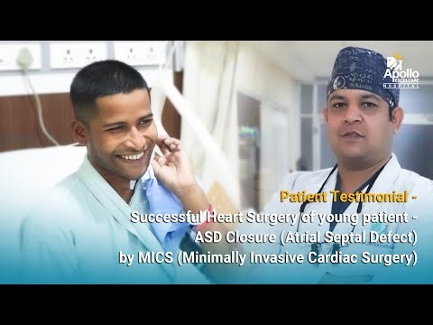 Successful heart surgery of young patient - ASD Closure by MICS (Dr. Intekhab Alam) Apollo Excelcare