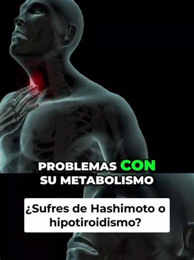 Problemas de Tiroides_ ¡Descubre tus Síntomas y Soluciones! Tu tiroides puede estar frenando todo tu metabolismo ⚠️ Problemas de tiroides, hipotiroidismo y síntomas que no debes ignorar En este video se explica cómo muchos casos de hipotiroidismo y problemas de tiroides no se deben solo a una falla hormonal, sino también a causas inmunológicas como Hashimoto. La hormona tiroidea influye en casi todo el cuerpo: desde el cerebro y la piel hasta el peso, el colesterol y la energía diaria. 🧠 Tambié