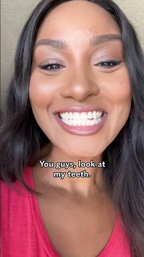 Smileactives Before and After Results ✨