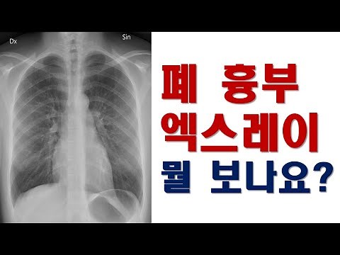 류마티스 질환, 자가면역질환 환자를 위한 폐흉부 엑스레이 보기