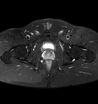 Why does my left hip hurt?