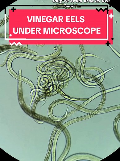 Vinegar Eels aka Nematodes Under A Microscope (worms that live in appl... | vinegar eels