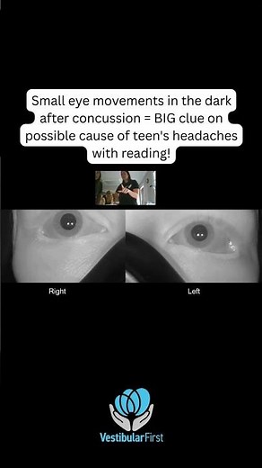 🦋 Voluntary flutter or "voluntary nystagmus," often associated convergence spasm. #concussion