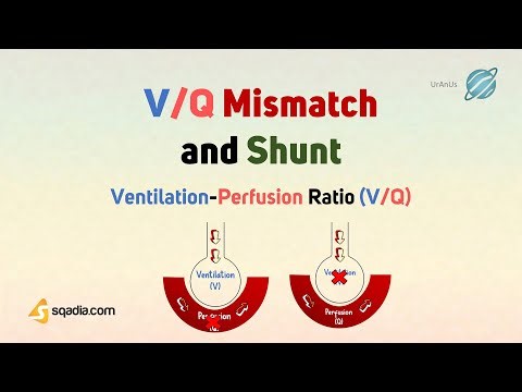 Ventilation-Perfusion Ratio (V/Q) | V/Q Mismatch and Shunt