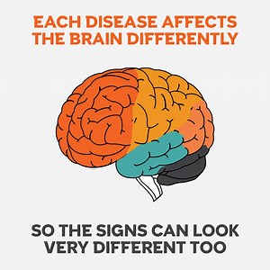 Dementia has many causes. Learn more about the signs and how to protect your brain. Request your FREE guide today. | Alzheimer's Research UK