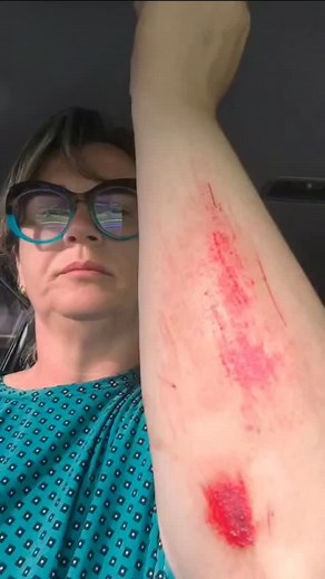 27K views · 2.1K reactions | Moradora de Camaquã, vítima de assalto no início da manhã deste sábado (25),relatou ao Clic Camaquã como tudo aconteceu. No vídeo, ela descreve os momentos de tensão e alerta a comunidade sobre a ocorrência. Saiba mais acessando Clic Camaquã - seu jornal diário na internet. | Clic Camaquã | Facebook