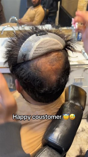 Transform Your Look with Beat Hair Patch