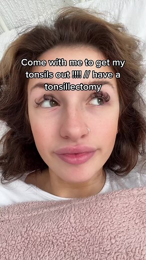 #tonsillectomy #operation #tonsilremoval #UARushChallenge