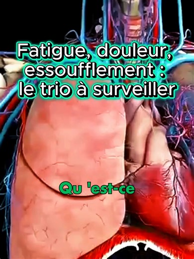 Un simple essoufflement ou une douleur dans la poitrine peut parfois cacher une urgence vitale… voici les signes de l’embolie pulmonaire à connaître. #santé #EmboliePulmonaire #poumon #Respiration #info