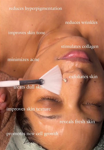 ✨ Refresh. Renew. Radiate. ✨ Reveal your best skin yet with our expert face peel treatment at LaBella Beauty Salon. Because glowing skin is always in! 💆‍♀️💖 📞 Book now: 9813475676 #LaBellaGlow #FacePeelMagic #RadiantSkin #GlowingSkinGoals #BeautySalonCare #SkinRevival #LaBellaBeauty #SkinTreatment #PeelAndGlow #SelfCareWithLaBella