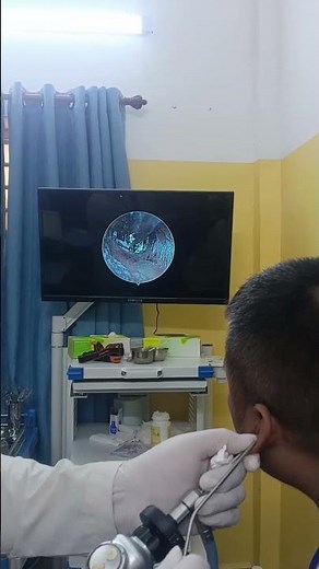 ENT Doctor Ear Examination 👂👨‍⚕️ #ENT #HealthCheck #MedicalVideo
