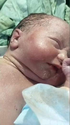 "Healthy Baby Delivered – Shifted to NICU for Further Care & Observation" #niculife #preemie