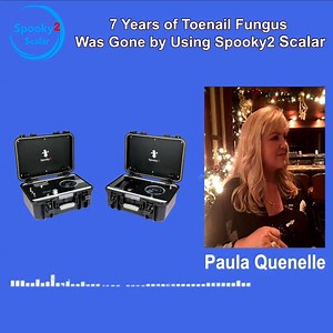 18 reactions | Spooky2 Scalar Success Story - Seven Years of Toenail...