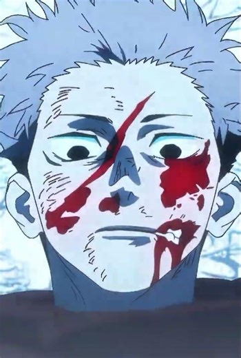 Top Anime Moments 🔥 | Epic Scenes You Must See #anime #shorts
