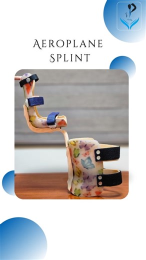 What is an airplane splint? | Global Grace Prosthetics And Orthotics posted on the topic | LinkedIn