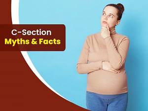 5 Myths Around C-Section Busted By Gynaecologist