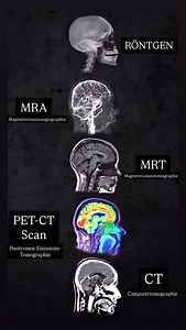 45K views · 3.5K reactions | Bildliche Unterschiede radiologischer Verfahren ☢️ #medizin #arzt #medizinstudium #medizinstudieren #krankenhaus #pflege #klinik #krankenpflege #radiologie #ct #mrt #röntgen | Sternzeichen Arzt | Facebook