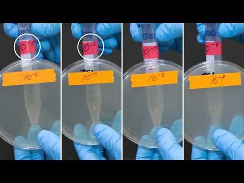 MCB2010C Lab: Serial Dilution and Plate Count