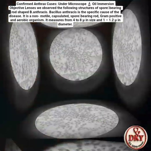 Bacillus anthracis || Non- motile || Capsulated || Spore bearing rod || Gram positive || Aerobic