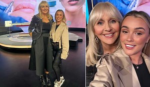 Irish Influencer Niamh O'Connor Lauded After Sharing Nightmare Cosmetic Filler Experience