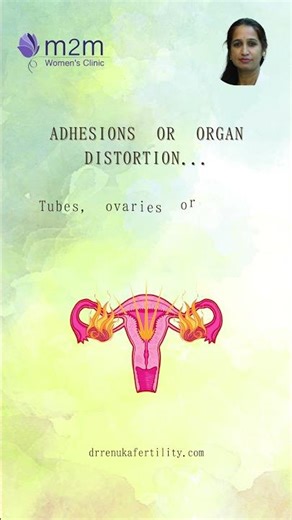 Endometriosis - When Is Surgery Needed ? Dr Renuka Ramaraju