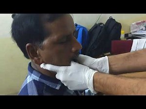 lock jaw reduction (dislocated TM joint )